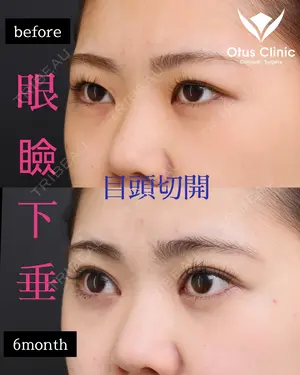 180 days after image