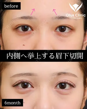 180 days after image