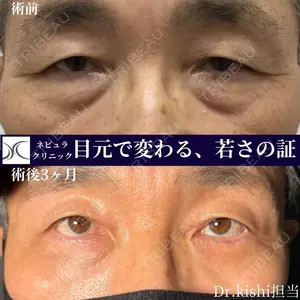 90 days after image