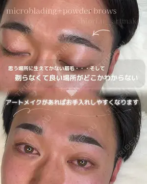 0 days after image