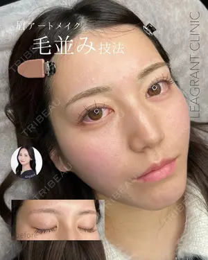 null days after image