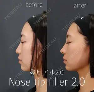 null days after image