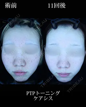 630 days after image