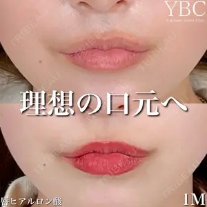 null days after image