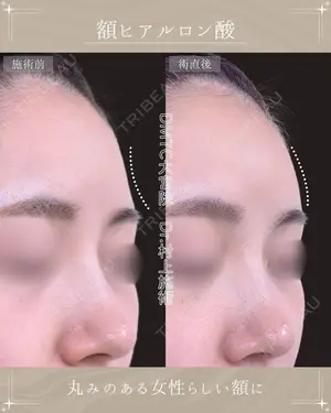 null days after image