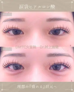 null days after image