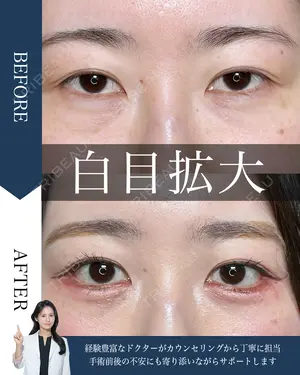 before image
