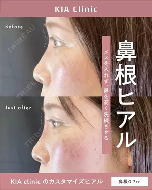 null days after image