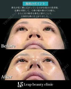 90 days after image