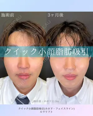 null days after image