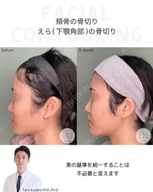 null days after image