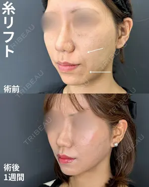 null days after image