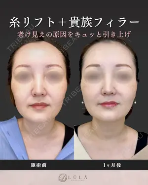 null days after image