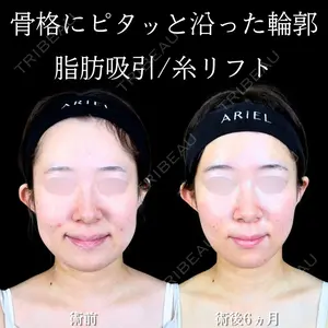 180 days after image