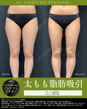 180 days after image