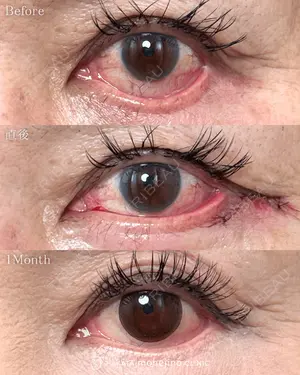 null days after image