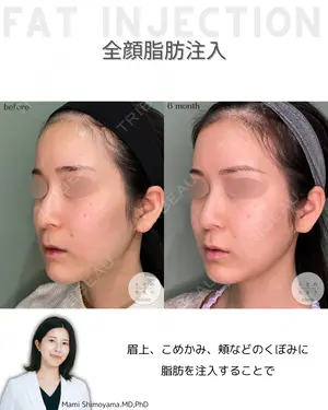 null days after image