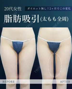 null days after image