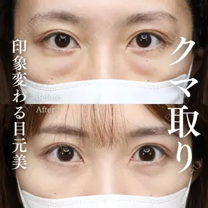 30 days after image