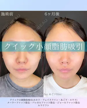 null days after image