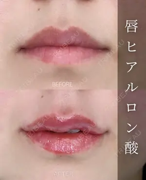 null days after image