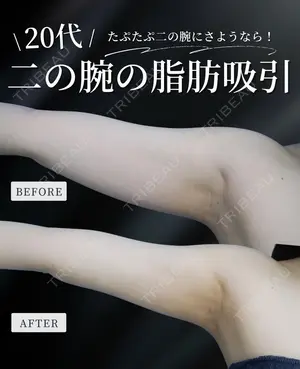 null days after image