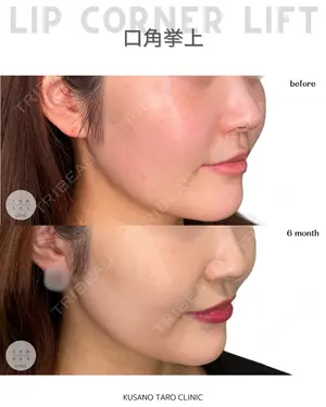 null days after image