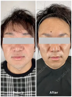 null days after image