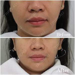 null days after image