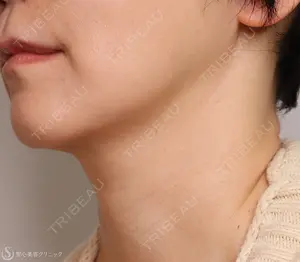 1825 days after image