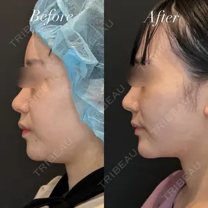 null days after image