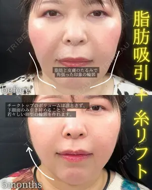 150 days after image