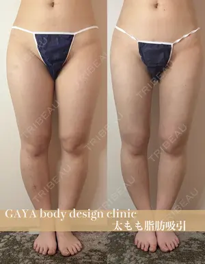 null days after image