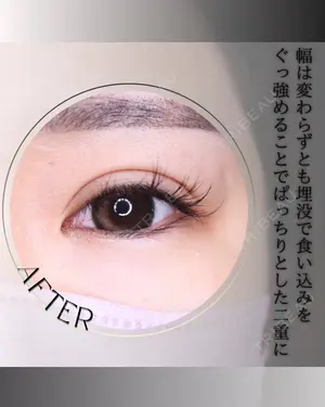 null days after image