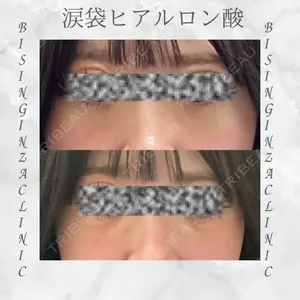 null days after image