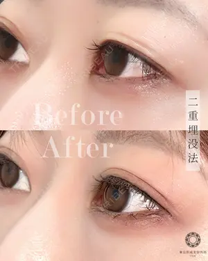 null days after image