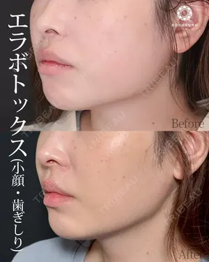 null days after image