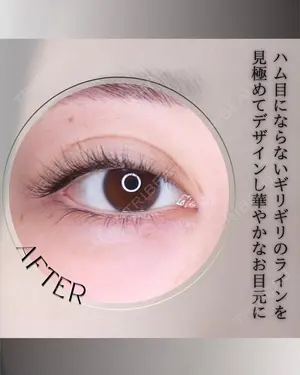 null days after image