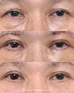 null days after image