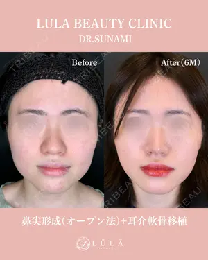 180 days after image