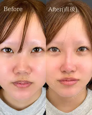 null days after image