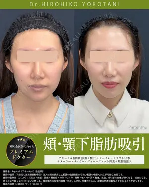 180 days after image