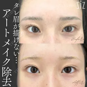 null days after image