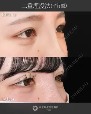 null days after image