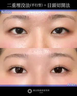 null days after image