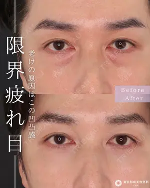 null days after image