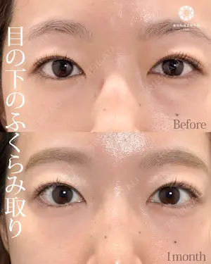 null days after image