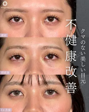 null days after image