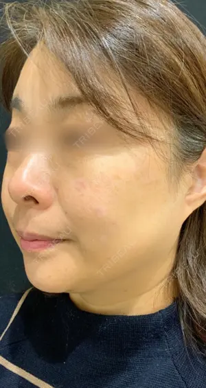 null days after image