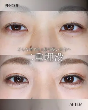 null days after image